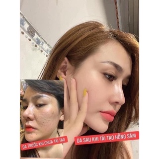 TÁI TẠO DA HỒNG SÂM + BỘT RỬA MẶT <Hàng chính hãng CTy>