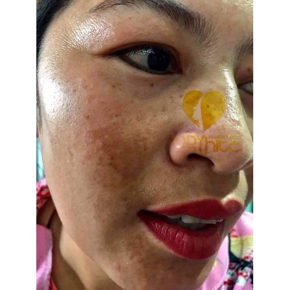 BẬT GÓC NÁM TÀN NHANG