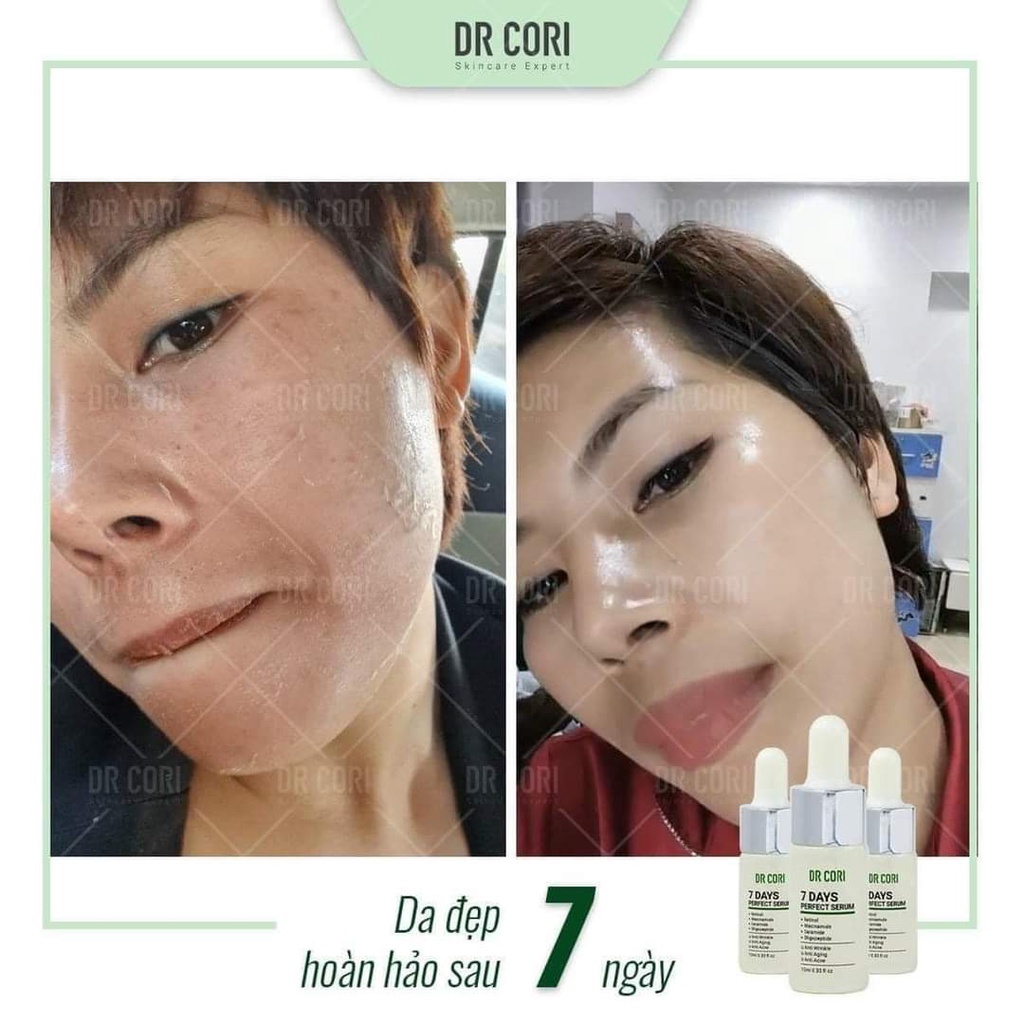 Tinh chất tái tạo Dr Cori 7 days perfect serum 10ml