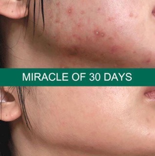 AHA-BHA-PHA 30 DAYS MIRACLE TONER