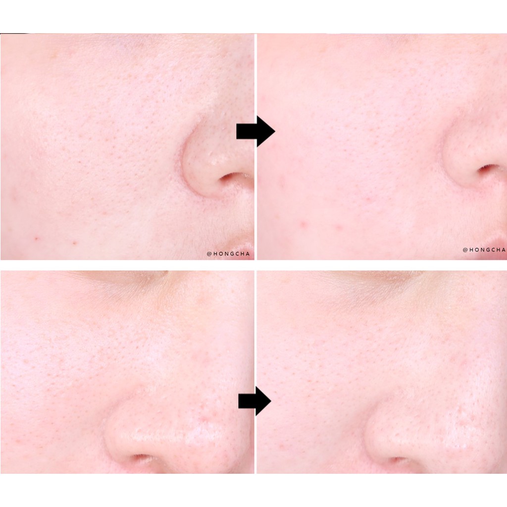 Sữa rửa mặt làm giảm và ngăn ngừa mụn đầu đen Some By Mi Bye bye blackhead 30 days miracle greentea tox bubble cleanser