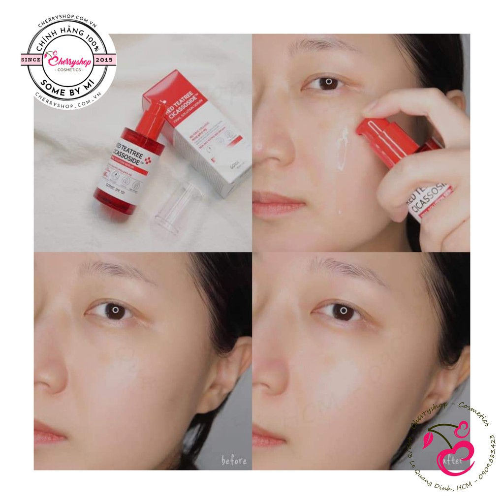 Tinh chất dưỡng SOMEBYMI Red Tea Tree Cicassoside Final Solution Serum