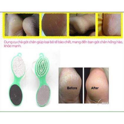 Bàn chải chà gót chân 4 in 1