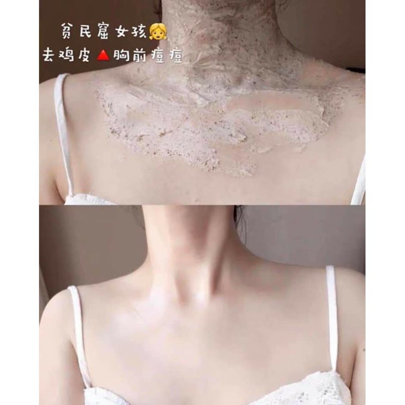 🌈🍑🍭 Kem Tẩy Tế Bào Chết Toàn Thân Peach Clear Body Scrub, Dưỡng Da Trắng Sáng, Giảm Thâm Sạm - Y306 | BigBuy360 - bigbuy360.vn