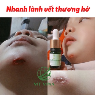 Tinh Dầu Đa Năng Evadiamond (Hỗ Trợ Các Vấn Đề Về Răng Miệng)