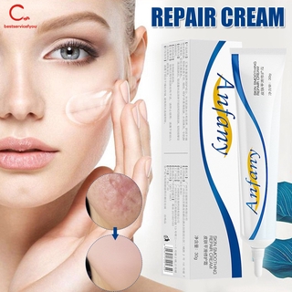 Scar Removal Cream Acne Removal Treatment Stretch Mark Scar Ointment Gel 30g