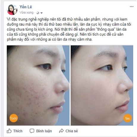Bộ sản phẩm chăm sóc da rau má rau má centella skin 1004 madagascar