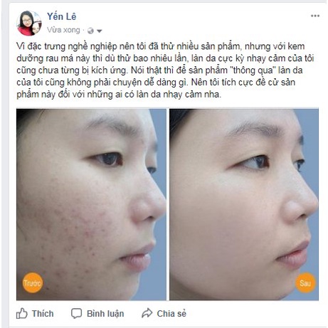 Bộ sản phẩm chăm sóc da rau má rau má centella skin 1004 madagascar