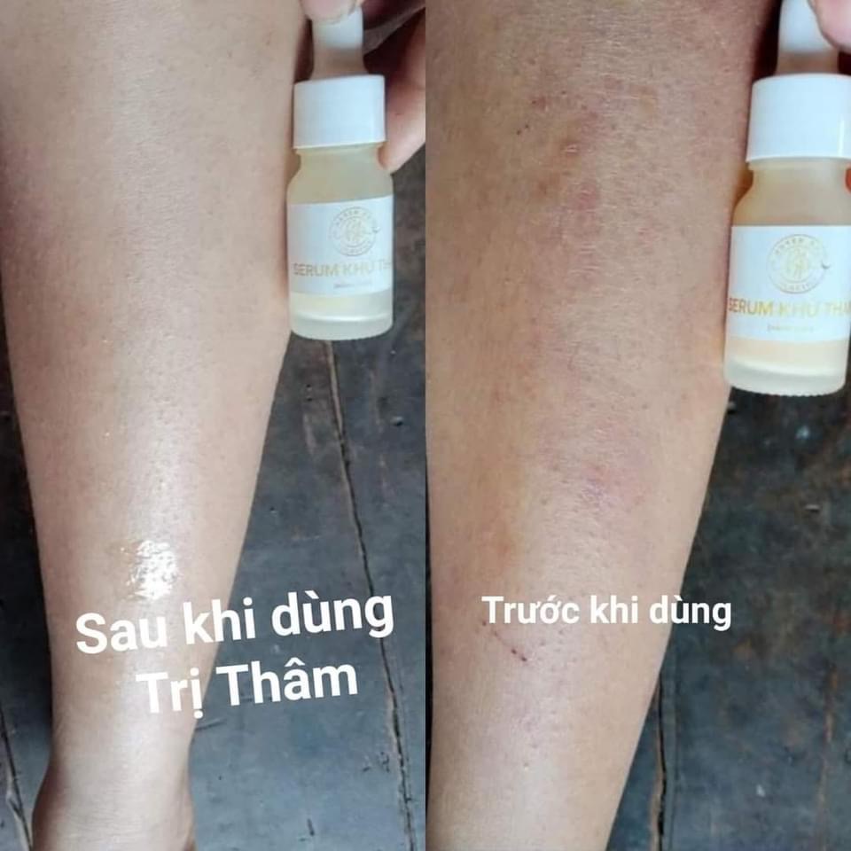 Serum khử thâm X2 Huyền Phi giảm thâm hiệu quả, giúp da trắng sáng tự nhiên thể tích 20ml