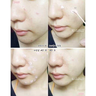 Lotion chấm mụn Bye Bye Blemish