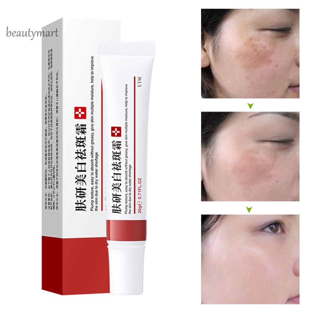 [Hàng mới về] Kem Dưỡng Trắng Da Mặt Chống Mụn Và Làm Sáng Da Nhanh Chóng Cho Nữ