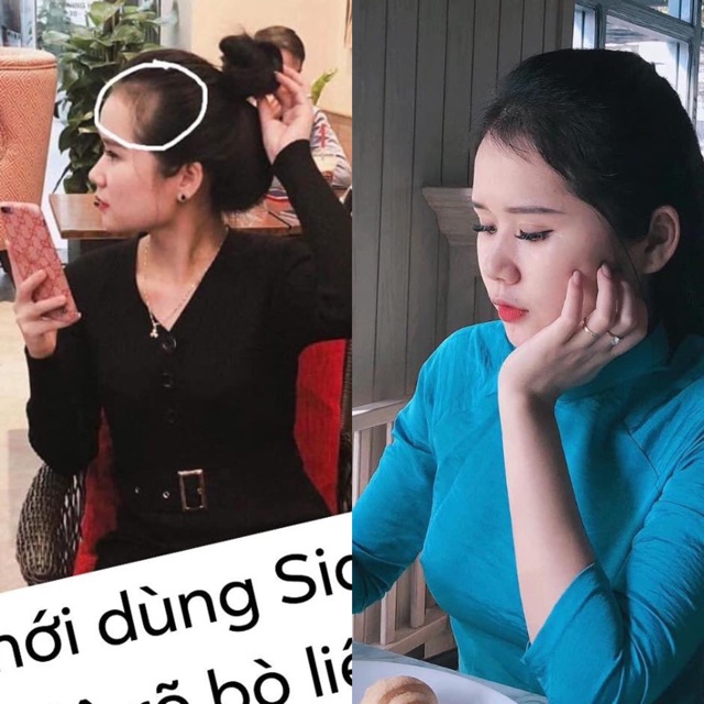 Xịt Tinh dầu bưởi non. Khắc tinh của hói, bò liếm, tóc mỏng | BigBuy360 - bigbuy360.vn