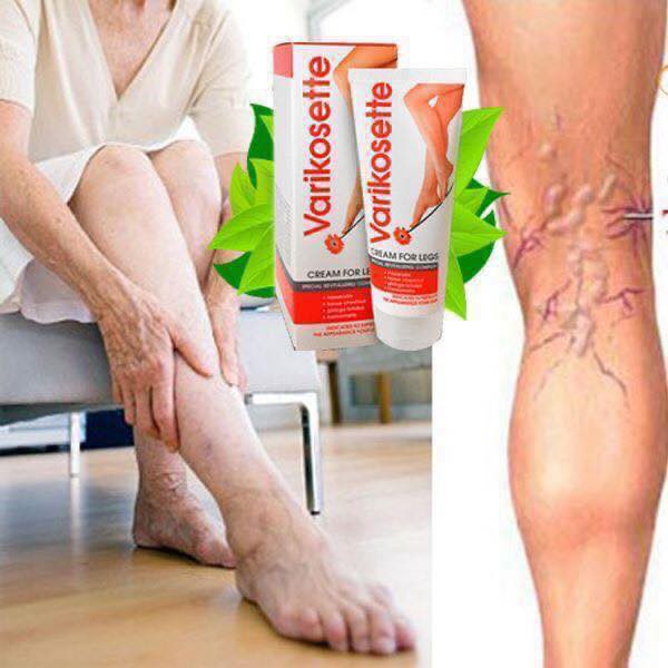 Kem giảm Suy Giãn Tĩnh Mạch Varikosette của Nga