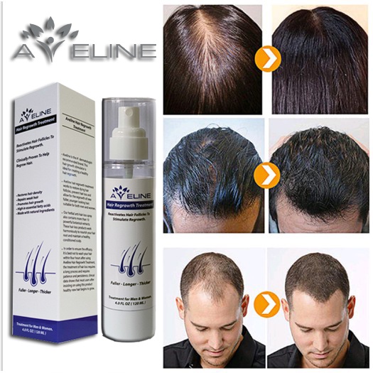 Thuốc mọc tóc Aveline - Mỹ