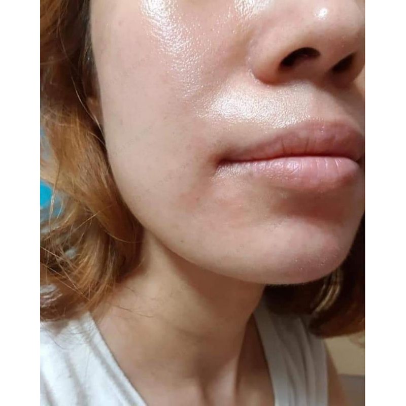 [Mã 153FMCGSALE giảm 8% đơn 500K] Toner Civasan Cấp nước phục hồi da mỏng yếu 100ml và 300ml | BigBuy360 - bigbuy360.vn