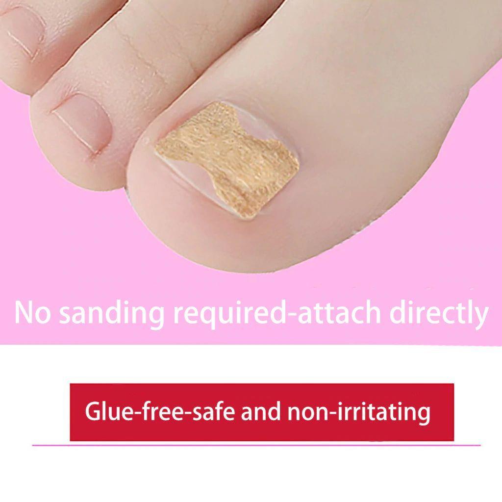 SOFTNESS Miếng Dán Chỉnh Hình Móng Chân Chuyên Nghiệp