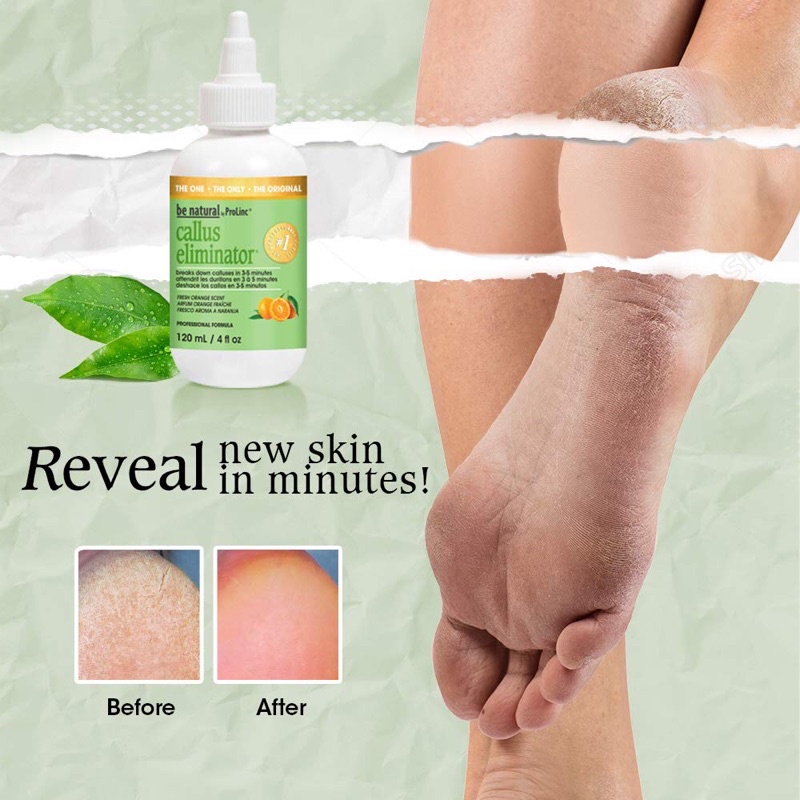 Dung Dịch Chà Gót Callus Eliminator Hàng nhập khẩu của Mỹ