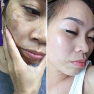 MẶT NẠ MÀNG TẾ BÀO GỐC HÀN QUỐC