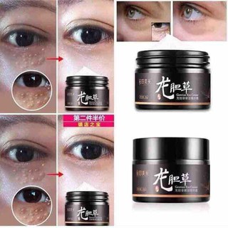 Kem đặc trị mụn thịt quanh mắt