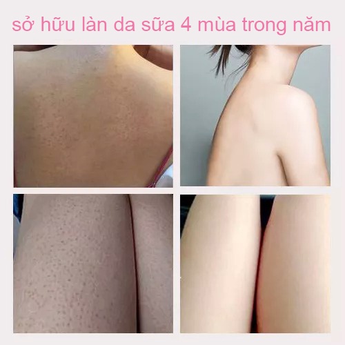 Sữa dưỡng thể trắng da Kem làm trắng cơ thể 320g Kem dưỡng ẩm trắng da body Niacinamide phù hợp cho mọi loại da