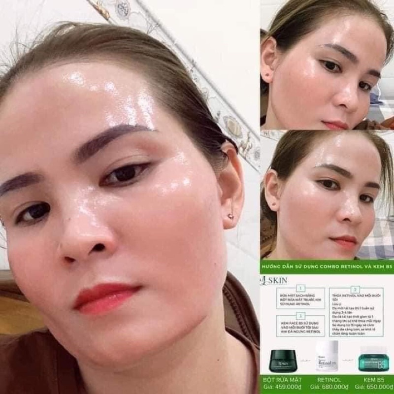Kem dưỡng phục hồi da B5 Mq skin - dưỡng ẩm và nuôi dưỡng làn da trẻ trung sáng mịn