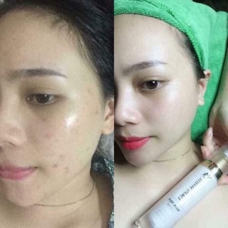 Ủ Kén tằm Lskin white Đan Thy