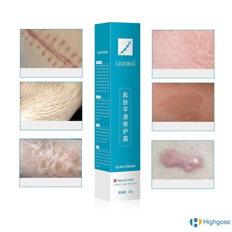 [Hàng mới về] Kem Hỗ Trợ Giảm sẹo dược liệu LIDORIA an toàn và hiệu quả