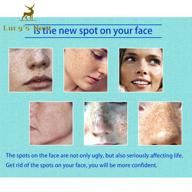 (Hàng Mới Về) Kem Trị Tàn Nhang Làm Trắng Da 20g | BigBuy360 - bigbuy360.vn