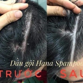 Dầu Gội Đầu HANAYUKI Shampoo