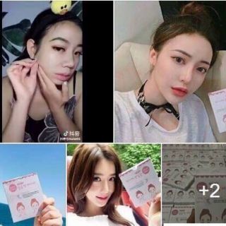 Miếng Dán Mặt Vline