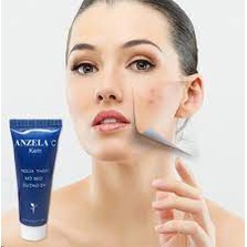 Kem Bôi Mờ Sẹo NC Anzela C