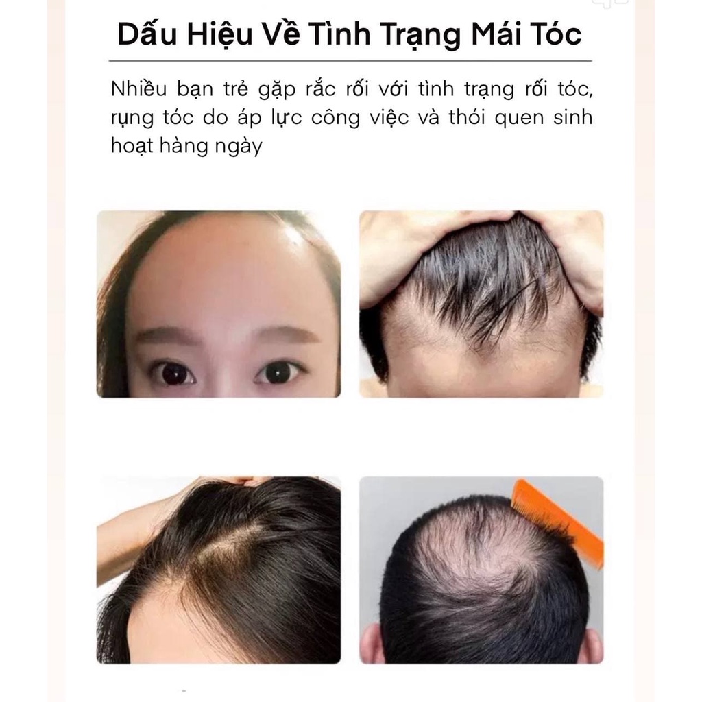 Dầu gôi gừng JOMTAM dầu gội mọc tóc, cân bằng lượng dầu giúp tóc chắc khỏe mềm mềm mượt ZUZU Cosmetic