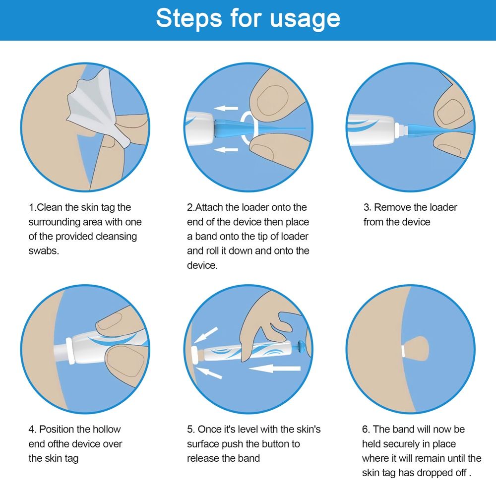 Bộ Dụng Cụ Hỗ Trợ Loại Bỏ Thẻ Da Trên Mặt/Cổ/Cơ Thể Mịn Màng Nhỏ Gọn Đến Nhỏ Trung Bình (0.08 Đến 0.2In)