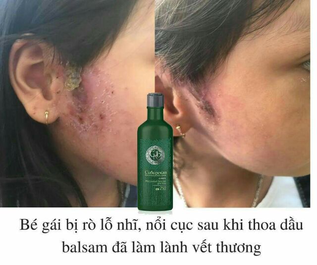 Dầu thoa Balsam của Siberian nước Nga (mẫu mới)