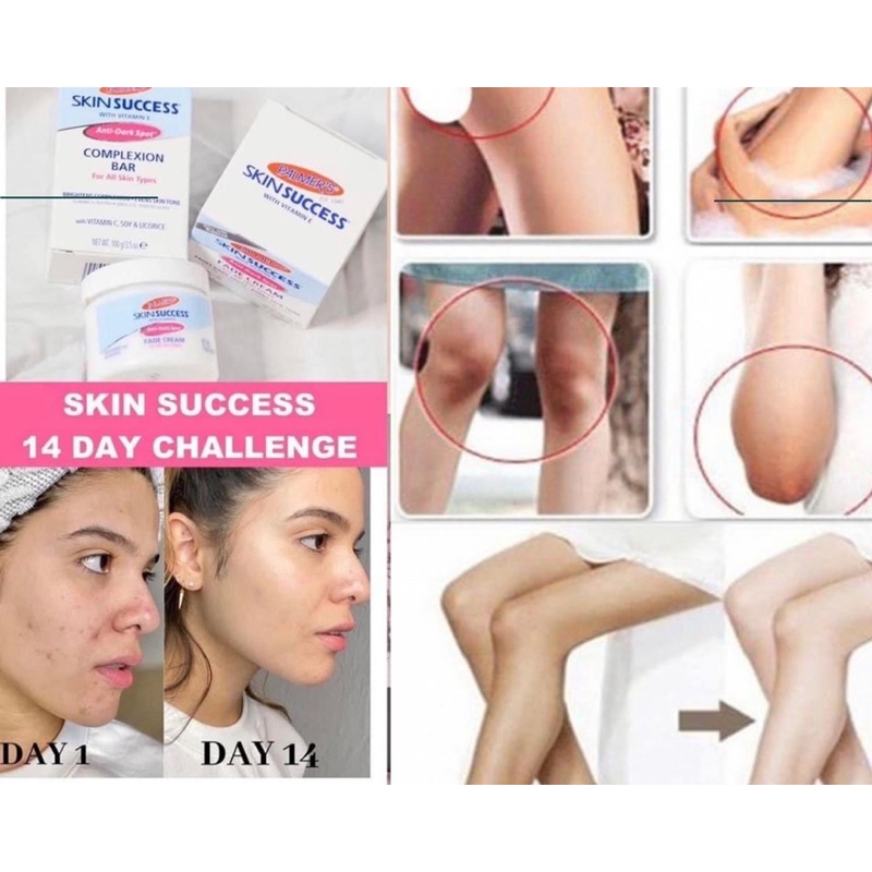 Bill US - Kem dưỡng Niacinamide làm trắng da, mờ thâm Palmers