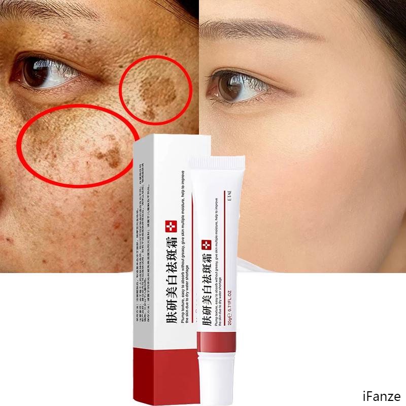 Kem Dưỡng Trắng Da Giảm Tàn Nhang Và Quầng Thâm 20g
