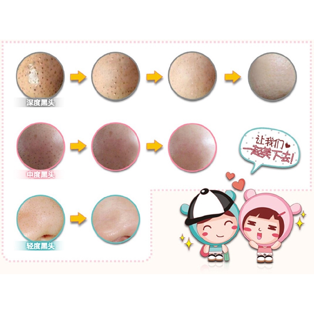 [Hàng mới về] Mặt Nạ Lột Mụn Đầu Đen Qipin 3 Bước Làm Sạch Da