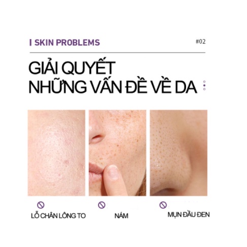Mặt Nạ Bùn Đất Sét bùn khoáng Làm Sạch Sâu Thông Thoáng Lỗ Chân Lông Nội Địa Trung Princess Beauty