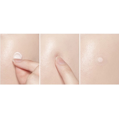 ETUDE HOUSE Bộ 44 miếng dán hydrocolloid chất lượng cao