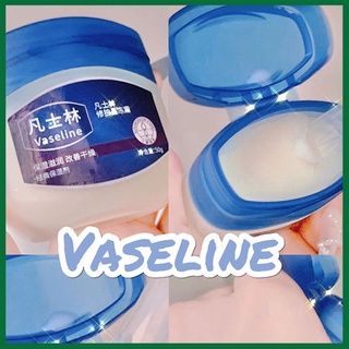 Son Dưỡng Môi Dạng Thạch VASELINE   Dưỡng Ẩm Chăm Sóc Môi Hiệu Quả FEY BEAUTY A53