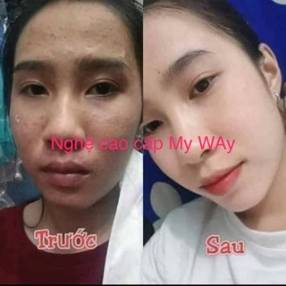 Set kem nghệ my way thái lan