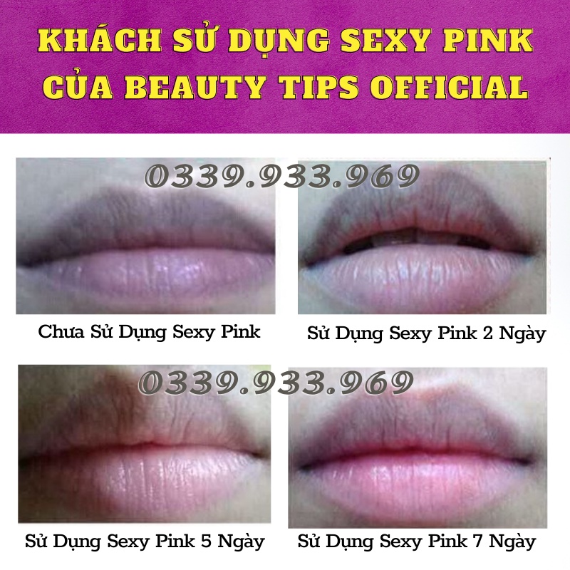 Kem Chống Thâm Môi - Làm Hồng Môi - Nhũ Hoa - Vùng Kín Sexy Pink Aichun Beauty 30g | BigBuy360 - bigbuy360.vn