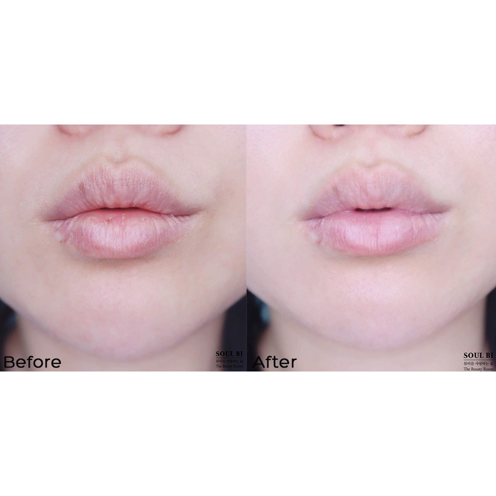 Tẩy Tế Bào Chết Sủi Bọt Cho Môi Unpa Bubi Bubi Bubble Lip Scrub 10ml | BigBuy360 - bigbuy360.vn
