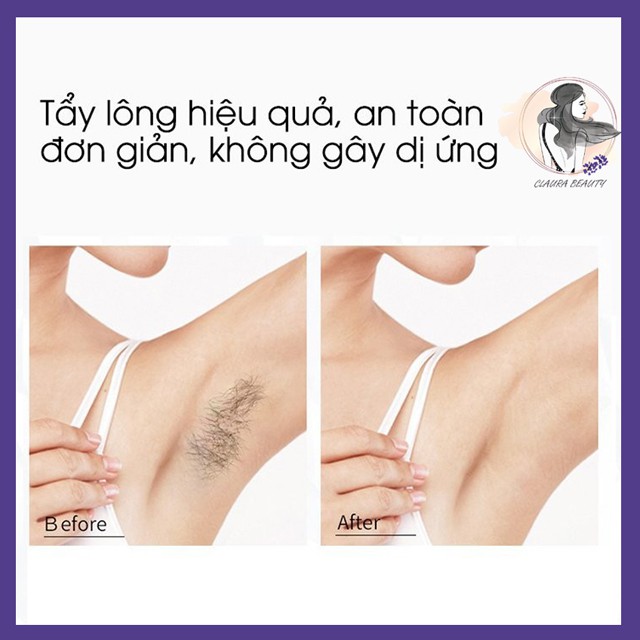 Kem Tẩy Lông Dạng Xịt Detvof, Tẩy Lông Chân Lông Nách, Lông Vùn Kín An Toàn Hiệu Quả Sau 5 Phút - Claura Beauty