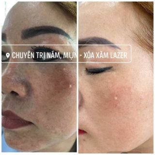 Sữa rửa mặt 2 IN 1 NSK