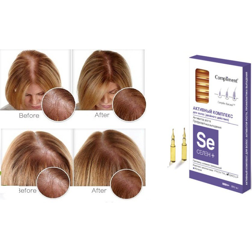 Serum kích thích mọc tóc, ngăn ngừa rụng tóc Compliment
