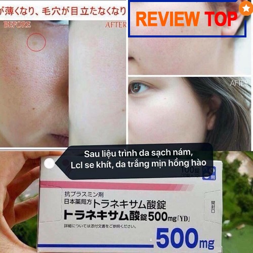 "hàng sẵn" sét 3 món dưỡng trắng da transamin, vitamin c, vitamin e hộp 100 viên