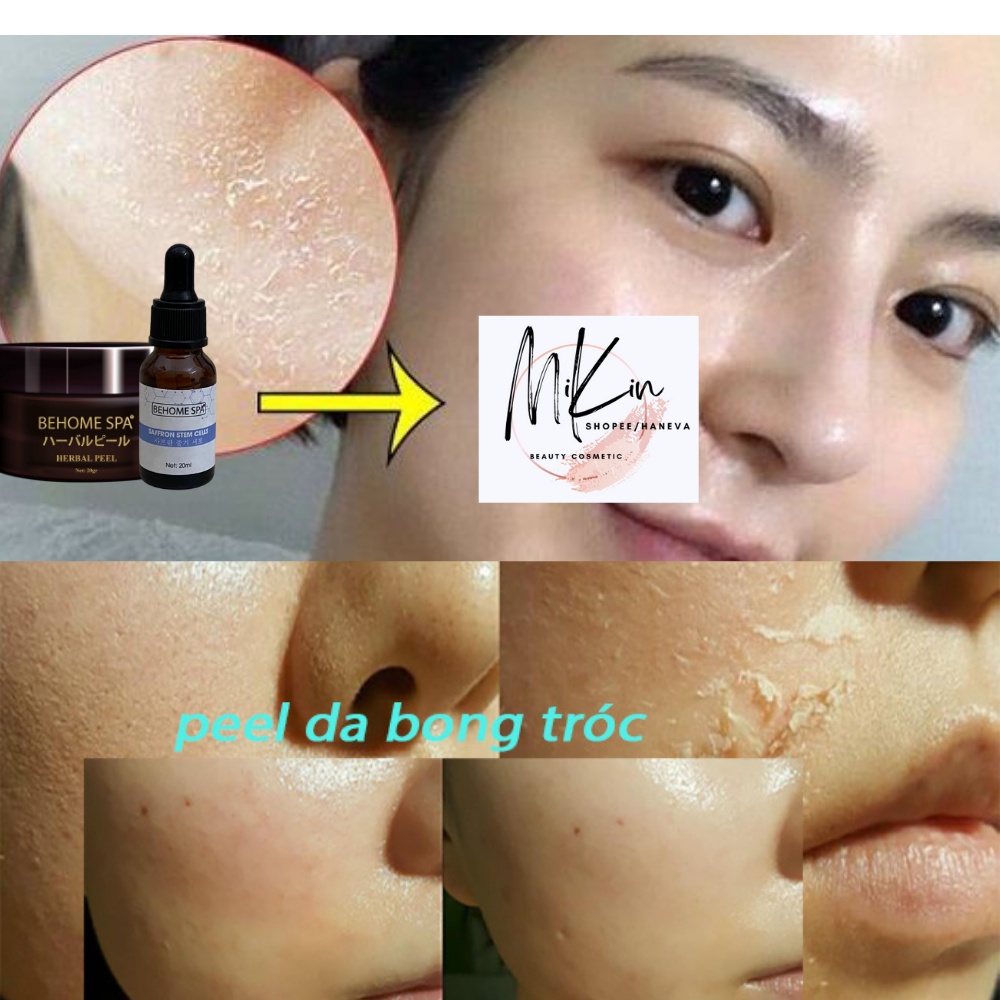 Thay Da Sinh Học HERBAL PEEL - BEHOMESPA Công Nghệ Nhật Bản