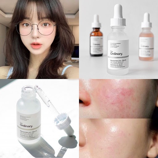 serum the Ordinary Niacinamide 10% + Zinc 1% sáng da, se khít lỗ chân lông, ngừa mụn | BigBuy360 - bigbuy360.vn