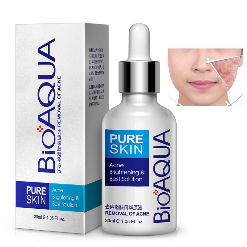 Tinh chất giảm mụn trứng cá, kiểm soát dầu [PỦRE SKIN] chứa hydrating của bioaqua Chính Hãng